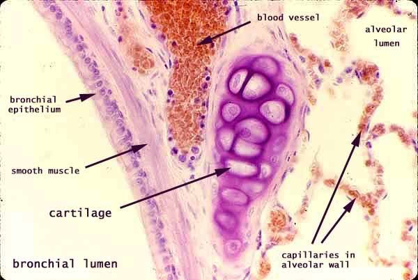 constriction of smooth muscle in the bronchioles